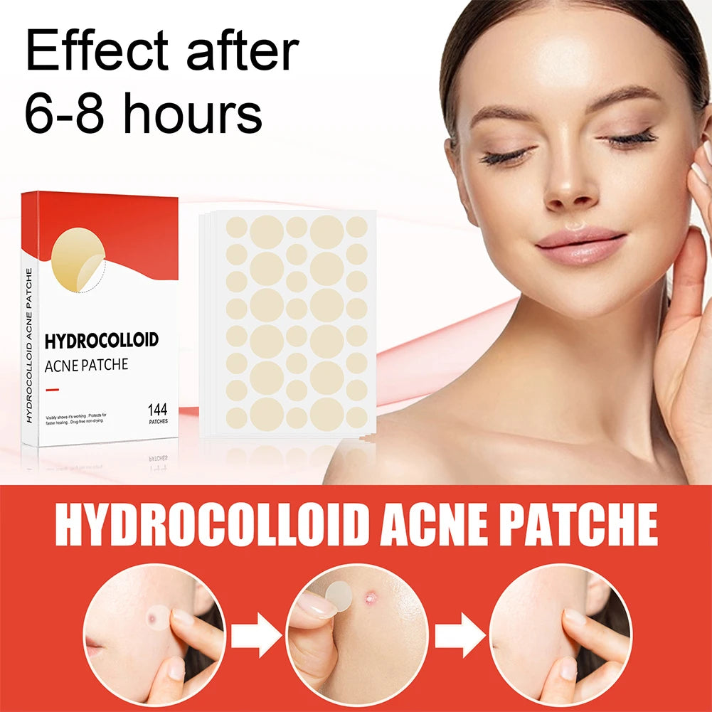 Hydrocolloid Pimple Patches