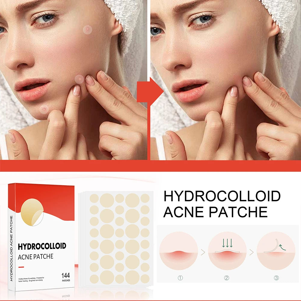 Hydrocolloid Pimple Patches