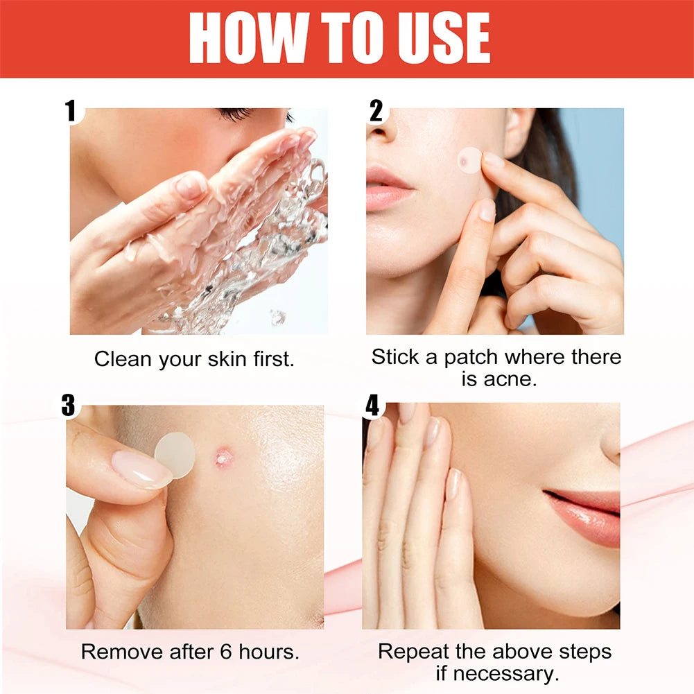 Hydrocolloid Pimple Patches
